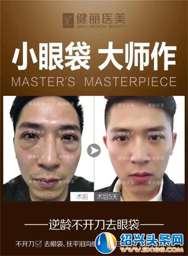 男去眼袋