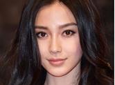 天生丽质却长了一口烂牙的7大明星