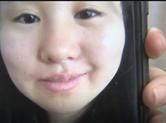 拔智齿之后 姑娘“不敢笑”
