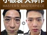 陈雪涛为35岁沧桑大叔去了眼袋和泪沟，秒变帅气小哥哥！