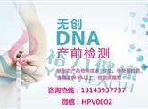 做无创产前DNA检测有哪些优势，检测结果准不准？
